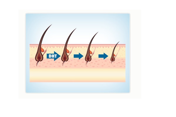 Tóc rụng nhiều